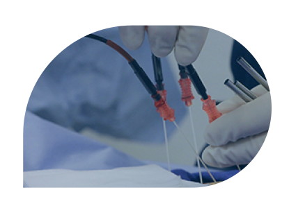 Radiofrequency Ablation Procedures